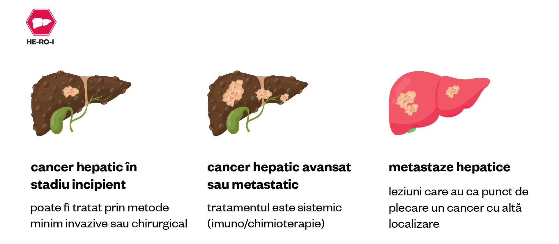 Infografică